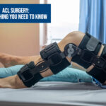 ACL Surgery Everything You Need To Know Dr Siddharth Aggarwal